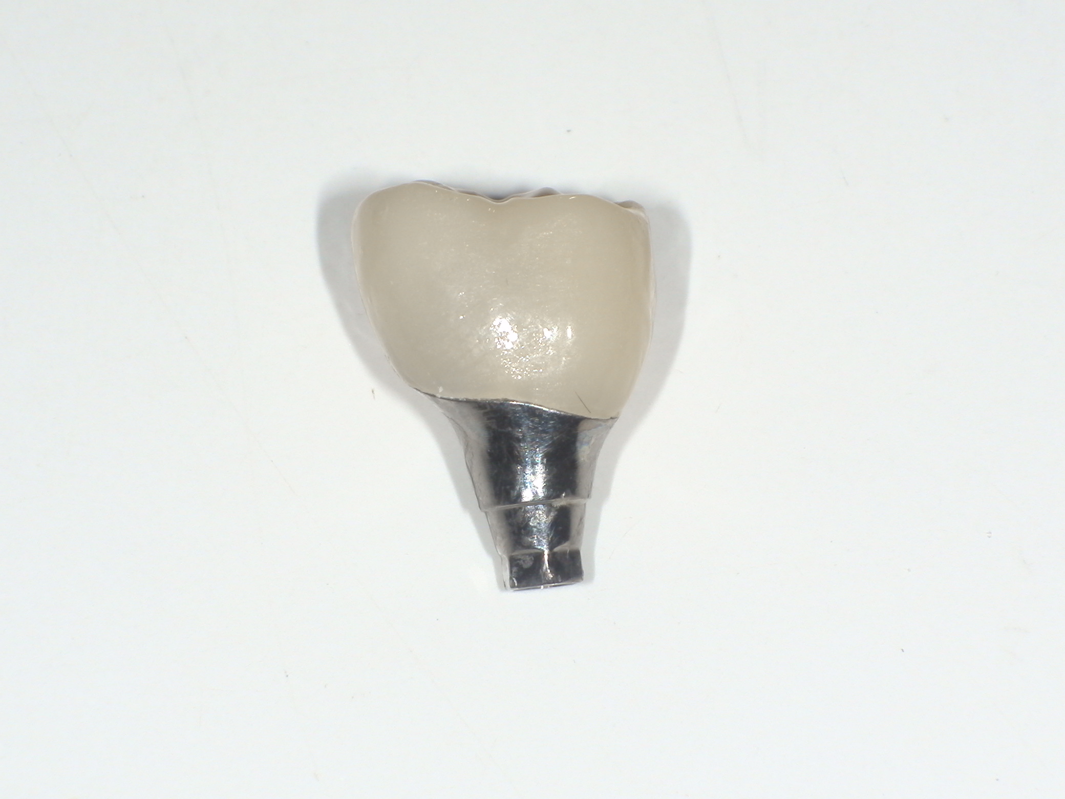 ソケットプリザベーション＆インプラント症例｜右下の奥歯が何もしなくても痛い5