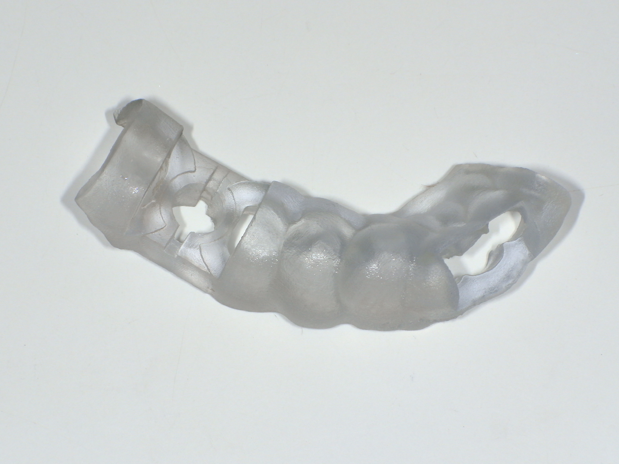 ソケットプリザベーション＆インプラント症例｜右下の奥歯が何もしなくても痛い7