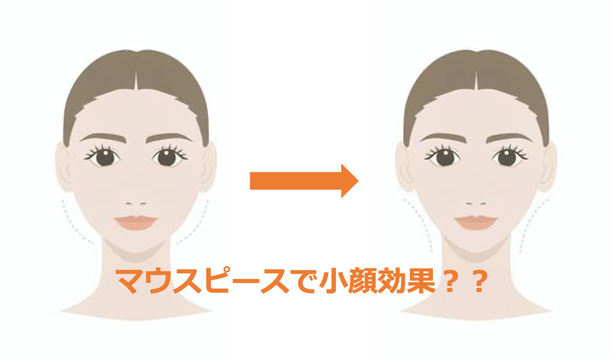 歯ぎしり用マウスピースの効果（ソフトとハードの違い）〜顔やせにも効果的？？〜