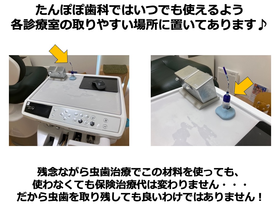 虫歯の取り残しがないようにするための、う蝕検知液を知ってますか？？4