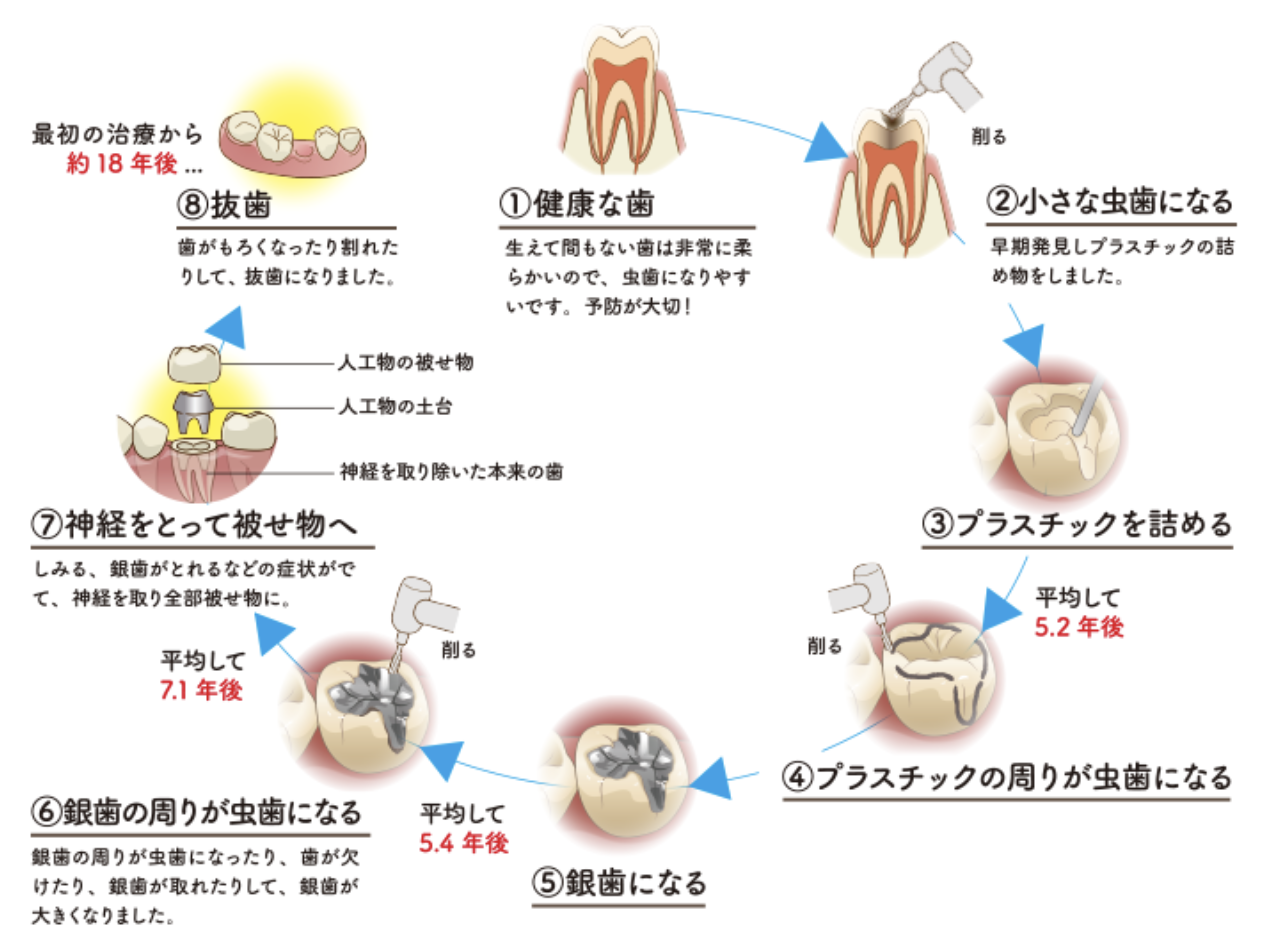 仕上げ磨きはいつまでするものなの？2