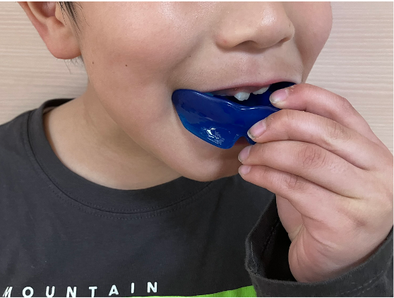 【小児矯正】子供の受け口（反対咬合）はいつから治療した方がいいの？最適な時期と当院の治療方針7