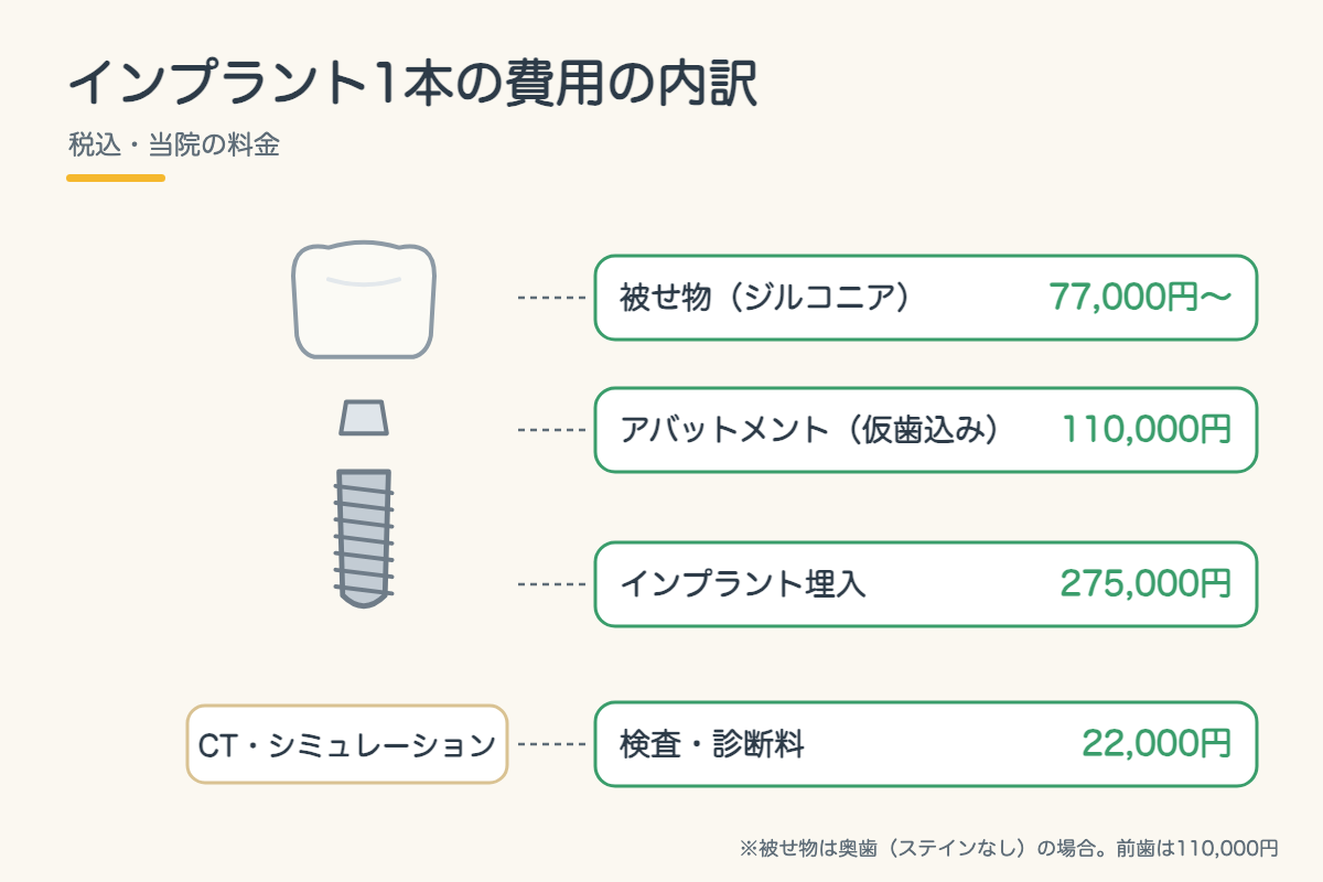 【インプラント】費用はいくら?1本あたりの内訳と、医療費控除・デンタルローンで負担を抑える方法|北九州市小倉南区3