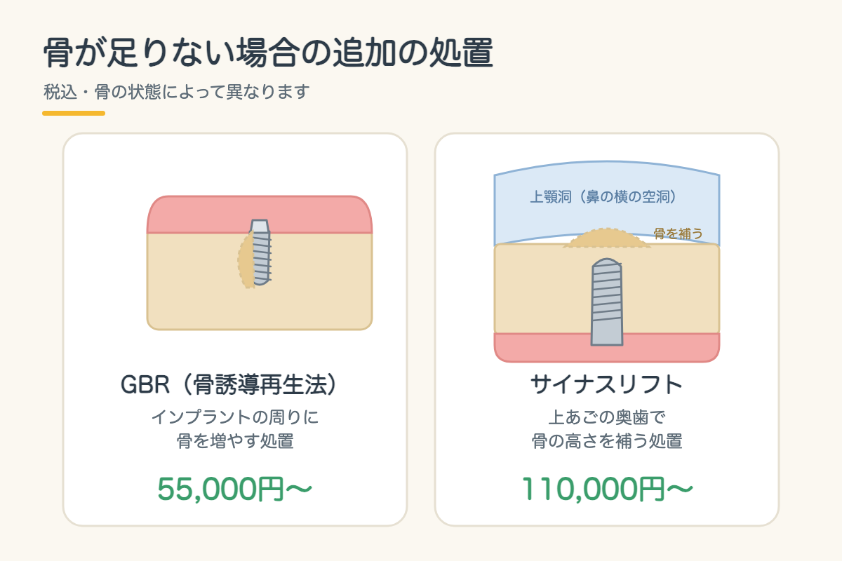 【インプラント】費用はいくら?1本あたりの内訳と、医療費控除・デンタルローンで負担を抑える方法|北九州市小倉南区5