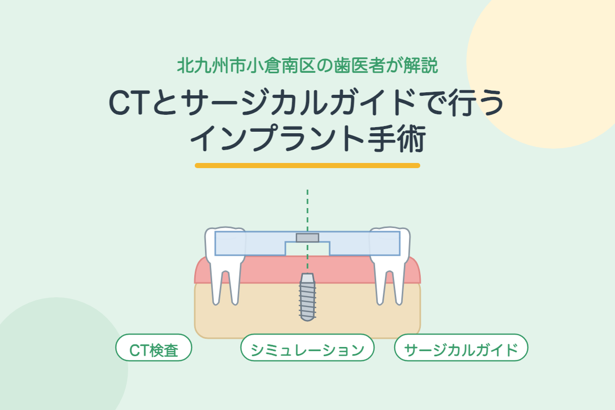 【インプラント】CTとサージカルガイドで安全性を高める手術とは？シミュレーションから埋入までを北九州市小倉南区の歯医者が解説