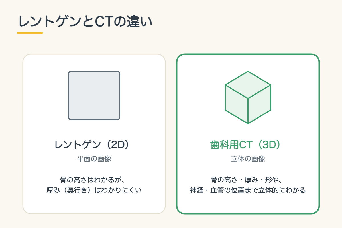 【インプラント】CTとサージカルガイドで安全性を高める手術とは?シミュレーションから埋入までを北九州市小倉南区の歯医者が解説2