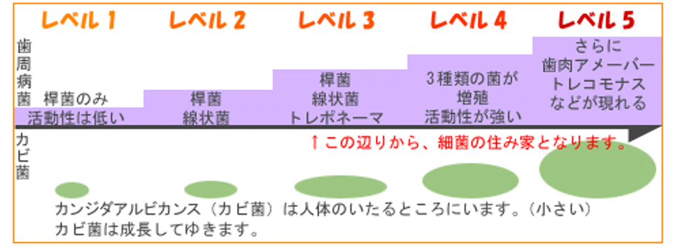 顕微鏡で歯周病がわかるの？？3