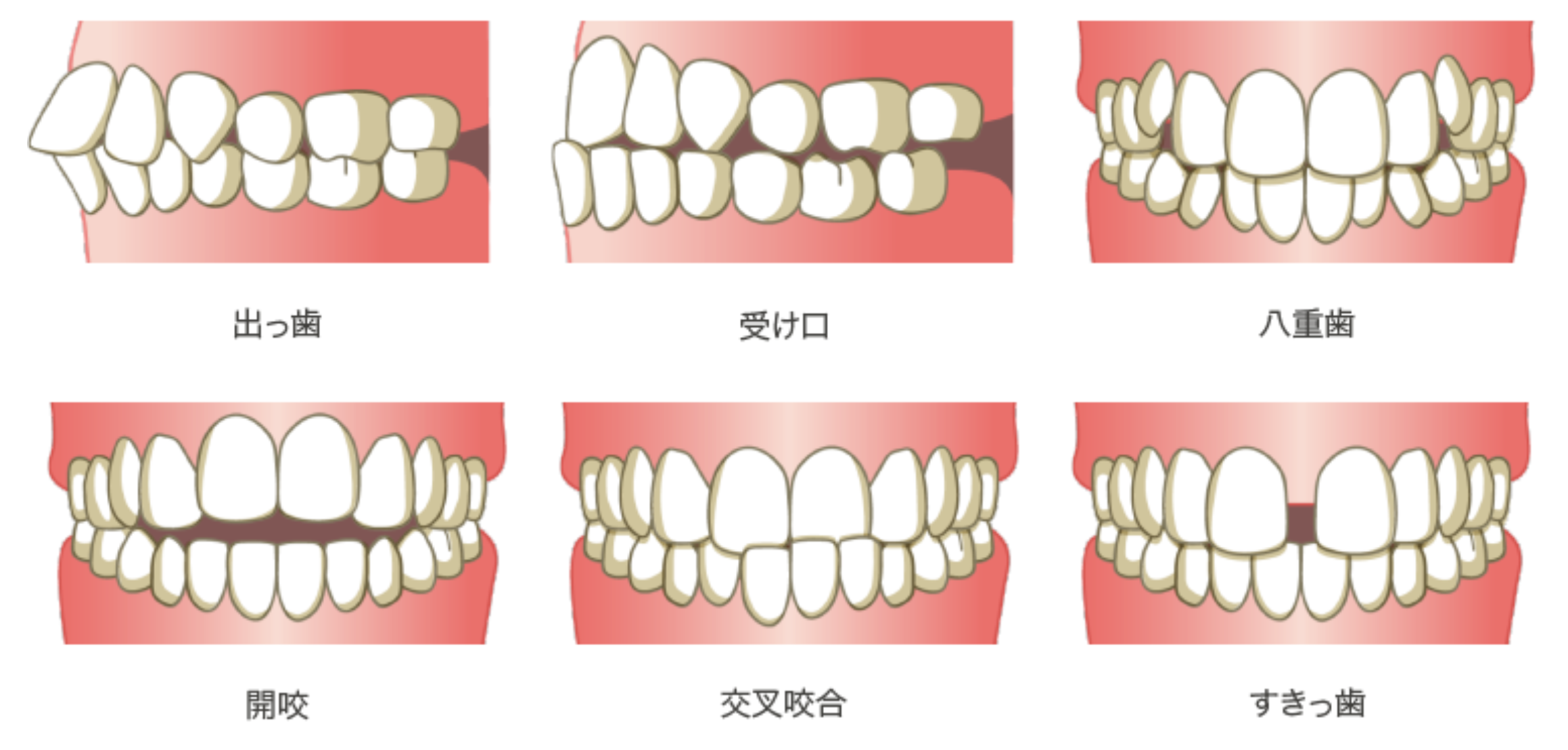 歯並びが気になりませんか？3