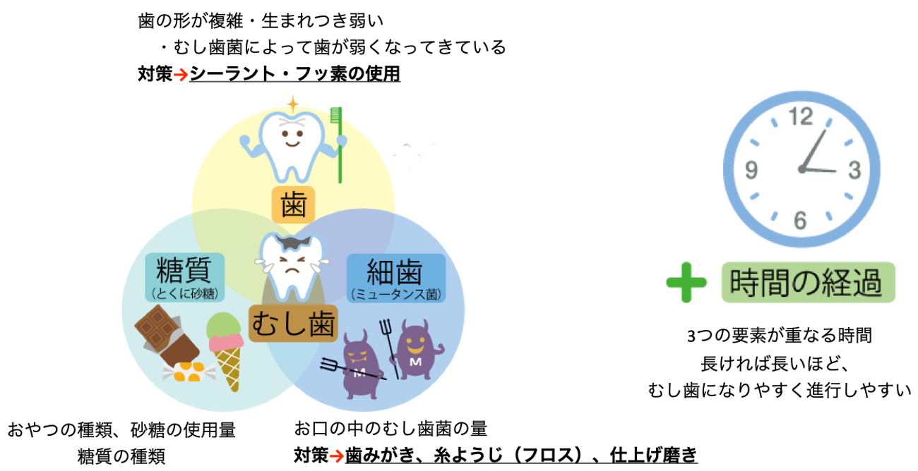 虫歯の原因となる砂糖について2