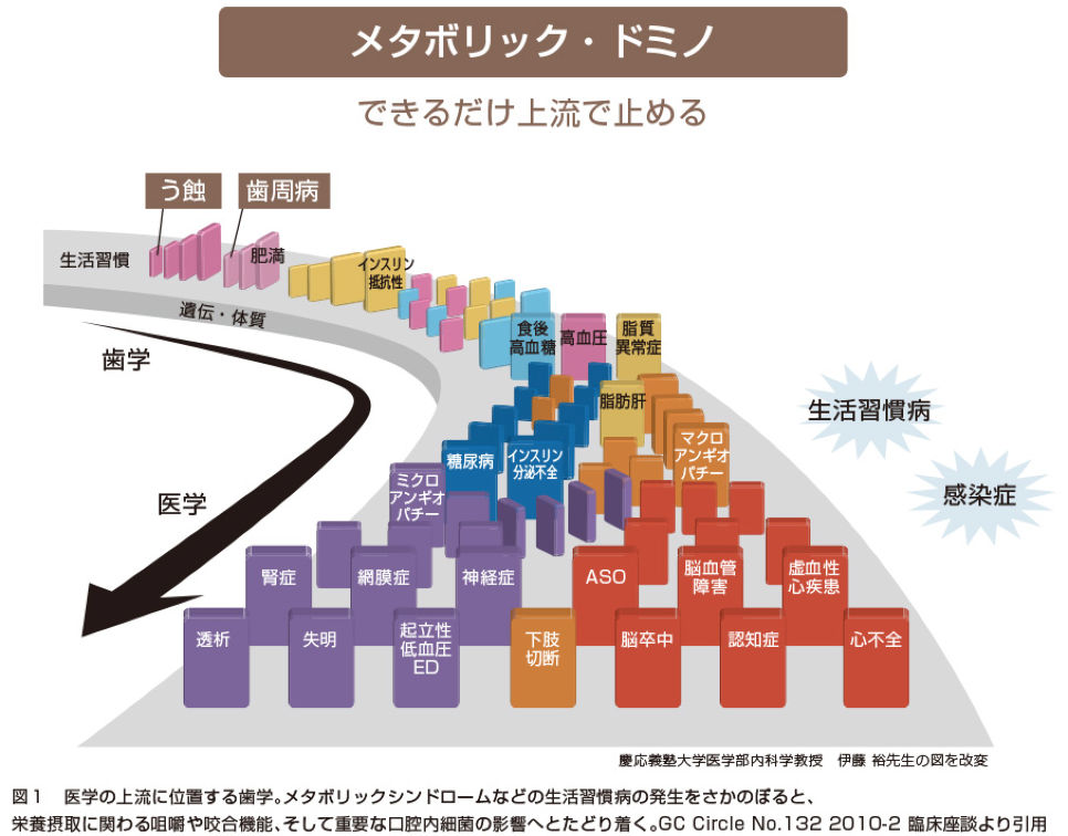 メタボリックドミノと虫歯・歯周病