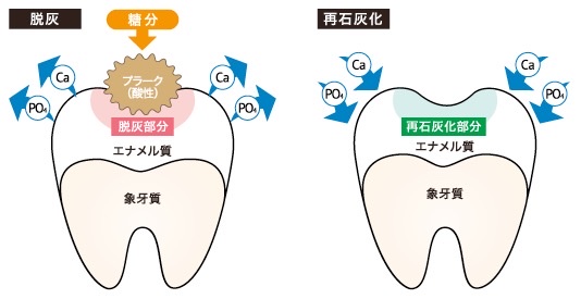 フッ素って毒なの？フッ素は塗った方がいいの？