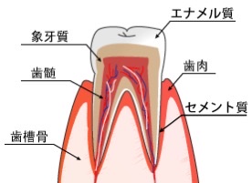 エナメル質形成不全の原因と治療について3