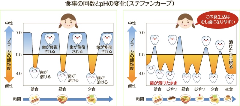 妊婦歯科健診は何のために受けたほうがいいの？