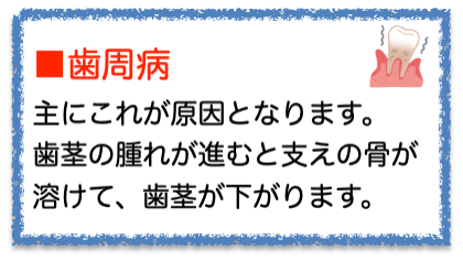 歯ぐきが下がってきた感じがする？？　その原因について6